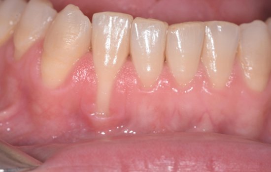 DR FAHAD BEFORE DR FAHAD BEFORE